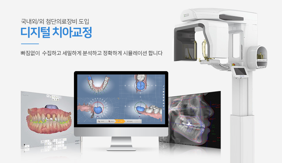 디지털 치아교정